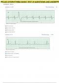 Relias Dysrhythmia Basic Test 35 Questions and Answers 2023 (Basic A Dysrhythmia)