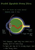 Diseases of the Vitreous 