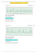 UPDATED 2024/2025 Relias Dysrhythmia Basic A Test 35 Questions and Verified Solutions / A Grade