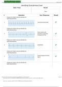 Identifying Dysrhythmias Exam