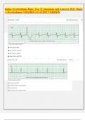 Relias Dysrhythmia Basic Test 35 Questions and Answers 2023 (Basic A Dysrhythmia) GRADED A LATEST VERSION