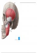 Muscles of Mastication - Labeling Diagram