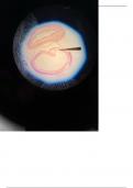 Histology of the Trachea & Esophagus - Labeling Diagram