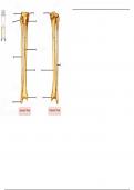 Tibia & Fibula - Labeling Diagram