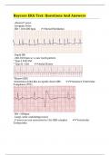 Baycare EKG Test: Questions And Answers