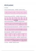 ACLS pretest(A+ GRADED VERIFIED 100%)LATEST VERSION 2023