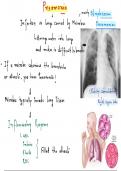 Notes on Pneumonia