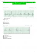 DYSRHYTHMIA BASIC A Competency Exam Relias-with 100% verified solutions-2023-2024