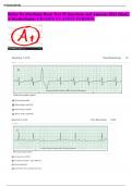 Relias Dysrhythmia Basic Test 35 Questions and Answers 2023 (Basic A Dysrhythmia) GRADED A LATEST VERSION