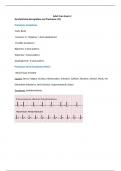 EKG strips 