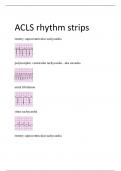 ACLS rhythm strips.