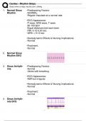 Cardiac - Rhythm Strips (Nursing) Solved 100% Correct!!