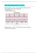 RCP 160 Cardioversion – Q’s & A’s