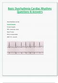 Basic Dysrhythmia Cardiac Rhythms Questions & Answers