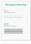 EKG Examples - Practice Strips