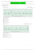 2024 Updated Relias Dysrhythmia Basic Test 35 Questions and Answers  (Basic A Dysrhythmia)100% Verified By Experts 