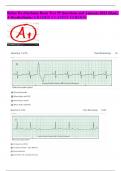 Relias Dysrhythmia Basic Test 35 Questions and Answers 2023 (Basic A Dysrhythmia)