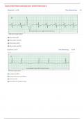 RELIAS DYSRHYTHMIA EXAM 2023/2024- DYSRHYTHMIA BASIC A