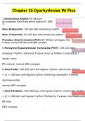 Chapter 35 Dysrhythmias W Pics COMPLETE LATEST UPDATE 2024