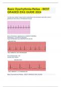 Basic Dysrhythmia-Relias - BEST GRADED EKG GUIDE Test Answers 2024 ( A+ GRADED 100% VERIFIED) 