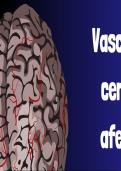 Vasculatura cerebral y sus complicaciones