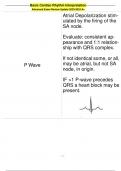 Basic Cardiac Rhythm Interpretation Advanced Exam Review Update 2023-2024 A+