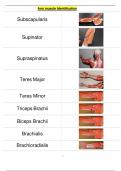 Arm muscle Identification