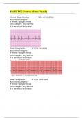 StaRN ECG Course- Sinus Family