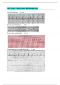 ECG Quiz – Questions With Solutions