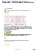 RELIAS DYSRHYTHMIA BASIC TEST ANSWERS 2023 DYSRHYTHMIA – BASIC A (A+ GRADED), Exams of Nursing