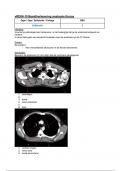 Beeldherkenning anatomie thorax