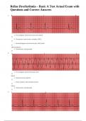 Relias Dysrhythmia – Basic A Test Actual Exam with Questions and Correct Answers