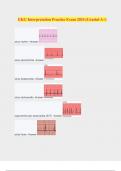 EKG Interpretation Practice Exam 2024 (Graded A+)