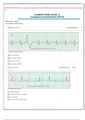 DYSRHYTHMIA BASIC A Competency Exam Relias (2024)Exam Elaboration Questions and Answers Graded A+