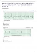 Relias Dysrhythmia Basic Test Answers 2024 (2 set)Dysrhythmia – Basic A ( A+ GRADED 100%  MOST VERIFIED FOR BEST QUALITY)