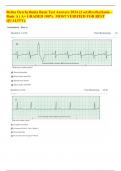 Relias Dysrhythmia Basic Test Answers 2024 (2 set)Dysrhythmia – Basic A ( A+ GRADED 100%  MOST VERIFIED FOR BEST QUALITY)