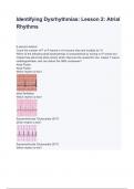 Identifying Dysrhythmias: Lesson 2: Atrial Rhythms questions and answers 