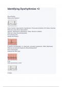 Identifying Dysrhythmias <3 questions and answers 