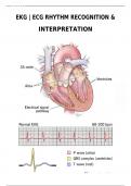   EKG | ECG RHYTHM RECOGNITION & INTERPRETATION