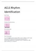 ACLS Rhythm  Identification