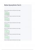 Relias Dysarythmia Test A Questions With Answers 