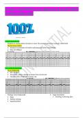 Cardiac dysrhythmia management & pacemakers LATEST APRIL 2024 Cardiac dysrhythmia