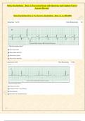 Relias Dysrhythmia Basic Test 35 Questions and Answers  (Basic A Dysrhythmia) 2024