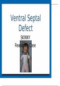    Ventral Septal Defect SKINNY Reasoning Case Study