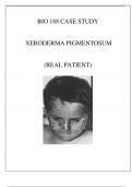 BIO 188 XERODERMA PIGMENTOSUM CASE STUDY REVIEW ( REAL PATIENT).