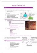 samenvatting endocarditis