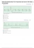 Relias Dysrhythmia Basic Test 35 Questions and Answers 2023 (Basic A Dysrhythmia) | 