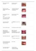 DENTAL HYGIENE OSCE EXAM ORAL PATHOLOGY WITH CORRECT MARKING SCHEME