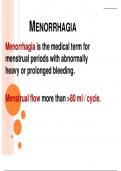 MENORRHEGIA.pptx with complete solution