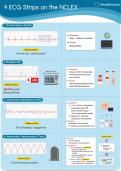 1. 9 ECG Strips on the NCLEX